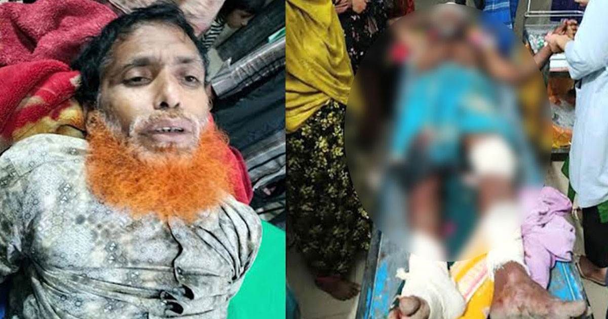মাগুরার শ্রীপুরে আধিপত্য বিস্তারকে কেন্দ্র করে দুই গ্রুপের সংঘর্ষ