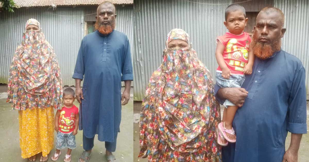 ১৯ বছর বয়স, তবু শিশুর মতো শরীর